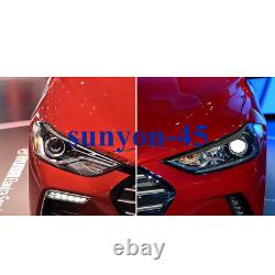 2017-2018 For Hyundai Elantra Carbon Fiber Head Light Lamp Eyebrow Eyelid Trim2
