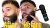 How To Fix Patchy Or Thinning Hair Beard By Applying Thick Fibers Hair Fibers My Secret